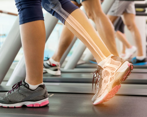 40311985 - digital composite of highlighted ankle of woman on treadmill