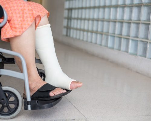 Senior adult leg injury sitting on wheelchair with plaster foot.